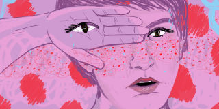 Lena Dunham: My Skin Was Perfect Until I Got Adult Acne